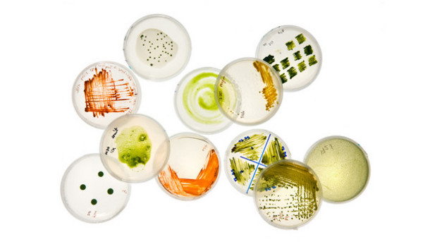 Foodborne Pathogens